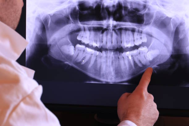 Best Cracked Tooth Emergency Dentist  in Wood River, NE