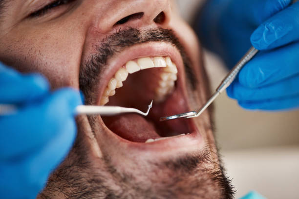 Best Knocked-Out Tooth Emergency  in Wood River, NE